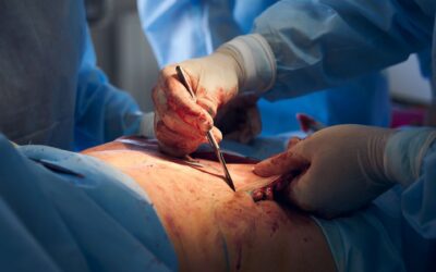 Evaluating Second Opinion Autopsy: Essential Factors