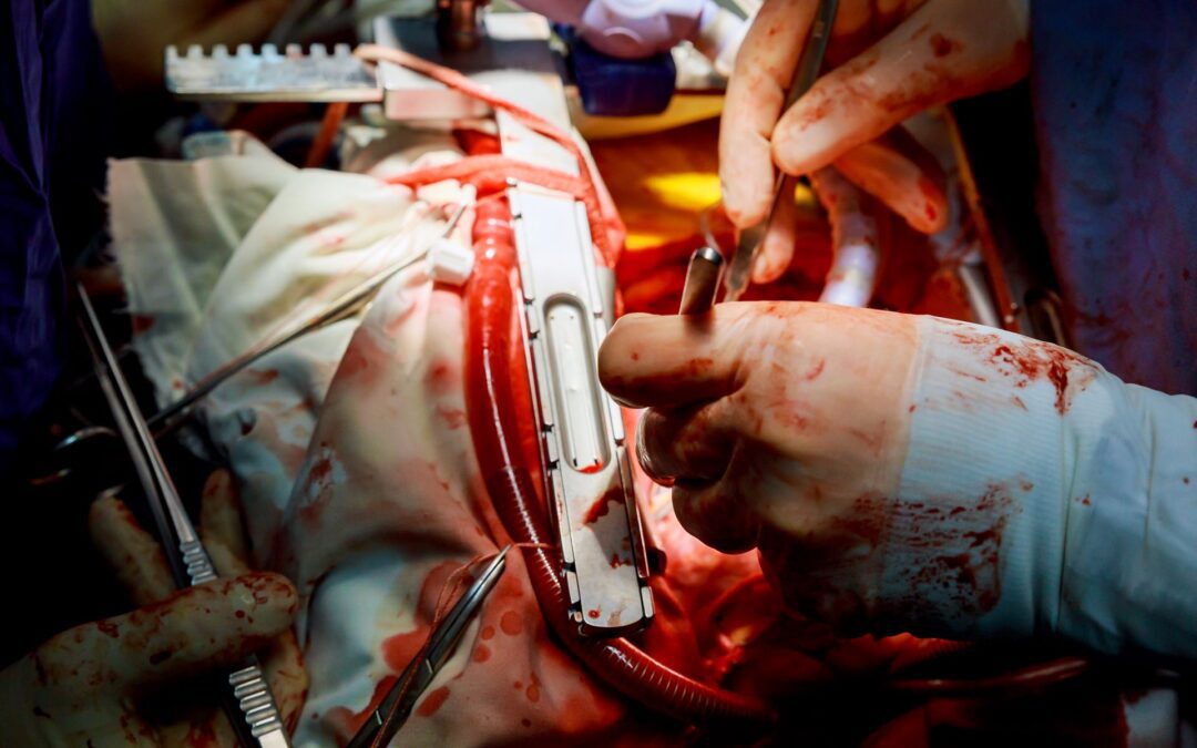 Autopsies