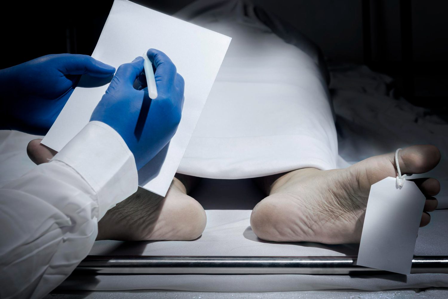 Knowing When to Consider a Second Opinion on Autopsy